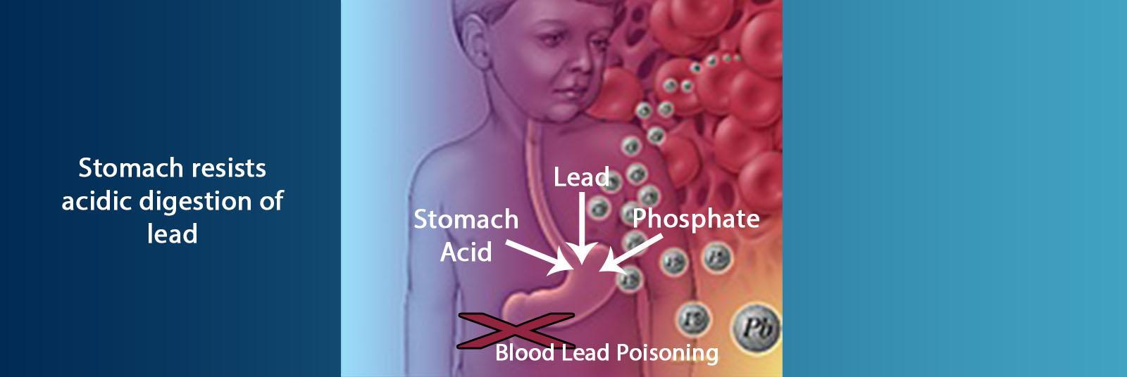 lead-stomach-ecobond